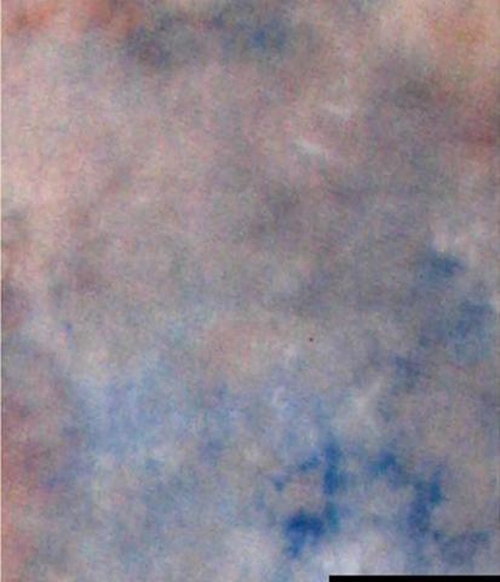 Linkstar Achtergronddoek S-122 2