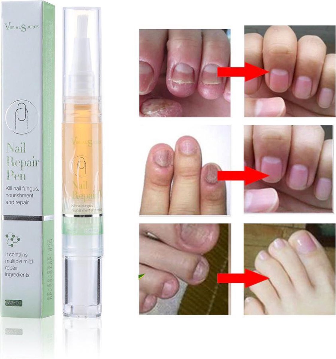 2 stuks Nagel RepairTreatment Liquid Pen