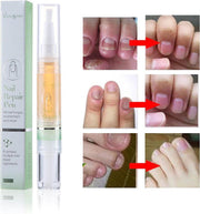 2 stuks Nagel RepairTreatment Liquid Pen