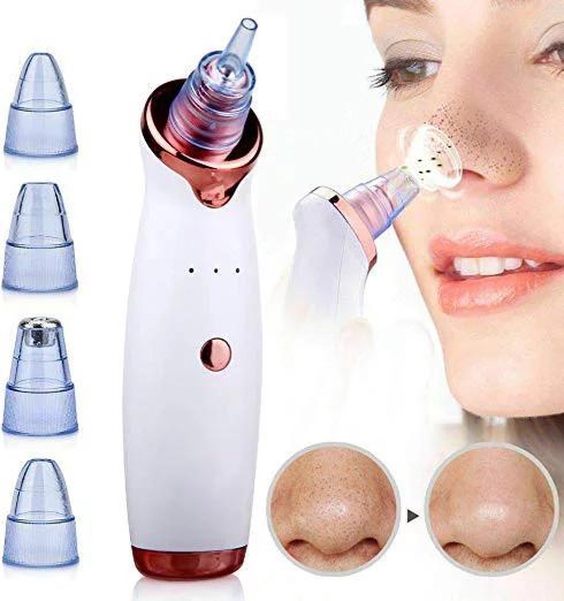 LOUZIR Elektrische Vacuüm  black head remover - mee-eter & acne verwijdering - oplaadbaar - gezichtsreiniger