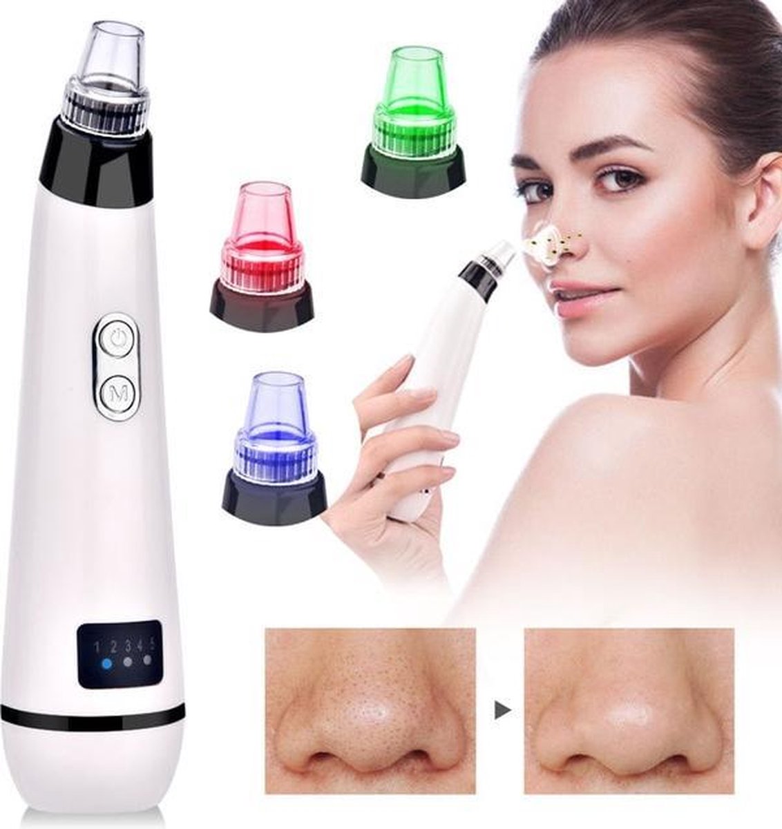 EKEO Vacuüm Blackhead Remover