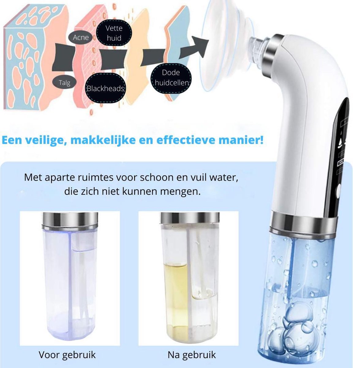 Sumer Blackhead remover-Draadloos-Hydrodermabrasie-Mee eters verwijderen-Microdermabrasie-Vacuüm cleaner-porie reiniger met bubbles-USB oplaadbaar-Blue Light Steralisation-