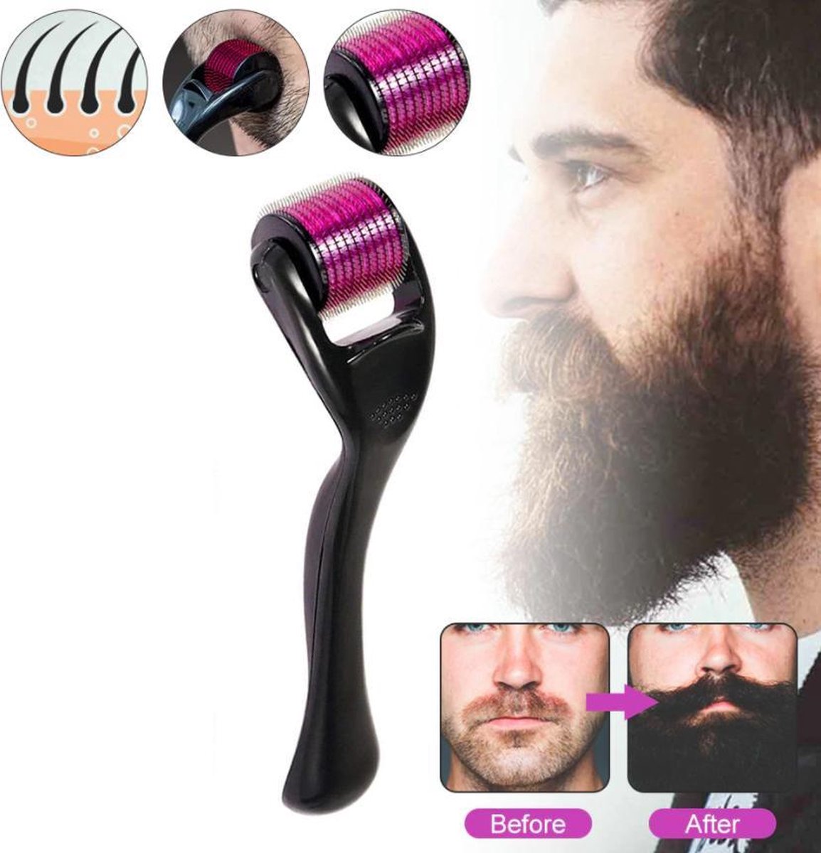 Baardgroei - Baard Roller 0.5mm – Baardgroei stimuleren – Baardroller – Huidverzorging – Baard verzorging