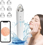 Blackhead remover met camera  – Mee eters verwijderen – Blackhead remover vacuüm