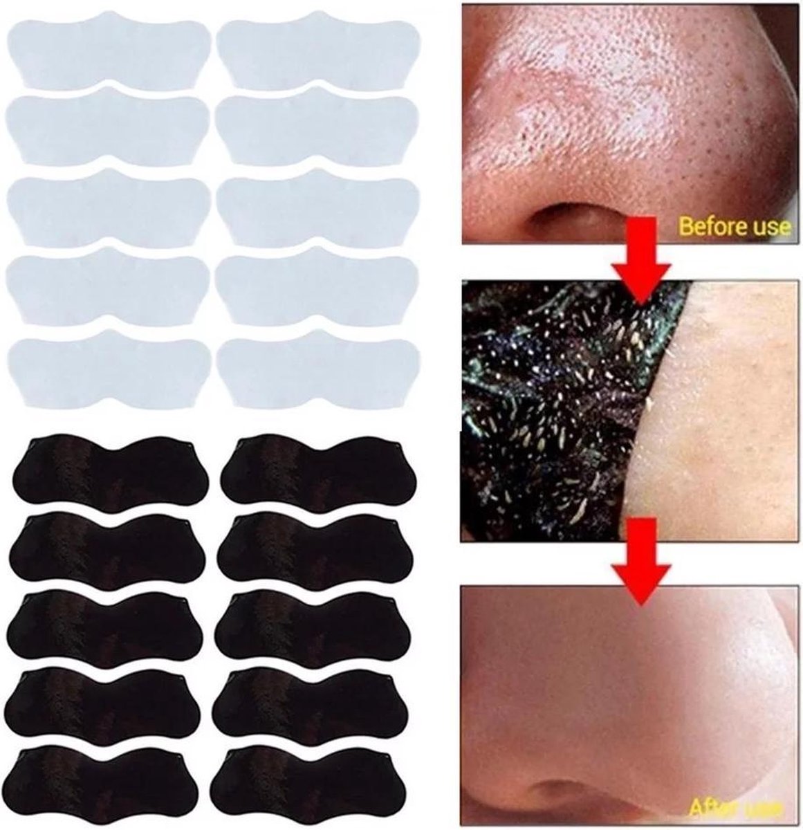 Mee-eters verwijderen- Neustrips- blackhead remover