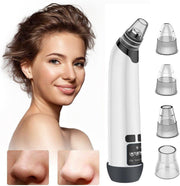 A&K Blackhead Remover Vacuüm - Mee-eter Verwijderaar - Inclusief 4 Opzetstukken
