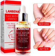 LANBENA Nail Repair Essence Serum