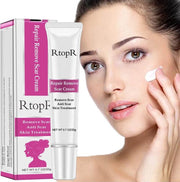 RtopR litteken creme