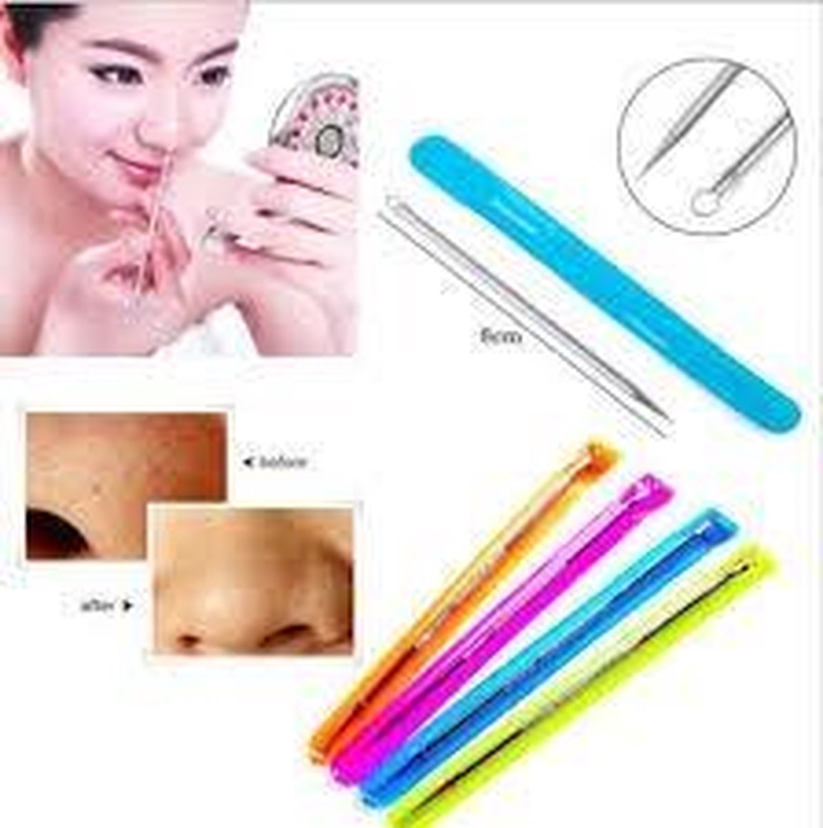 Now4You Comedonenlepel - mee eters verwijderen - acne verwijderen