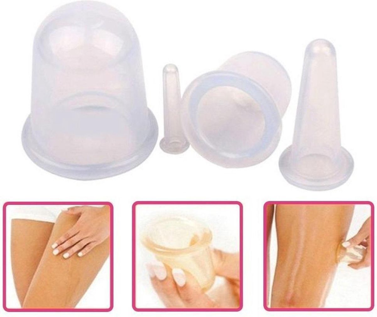 Lichaam cups|Professional|Premium Kwaliteit Cupping Cups|Voordeelset|Massage cupping|Anti Cellulitis|Facial cupping|Anti-aging|4-delig| Anti Sinaasappelhuid|Medische zuignappen|Transparante siliconen cups
