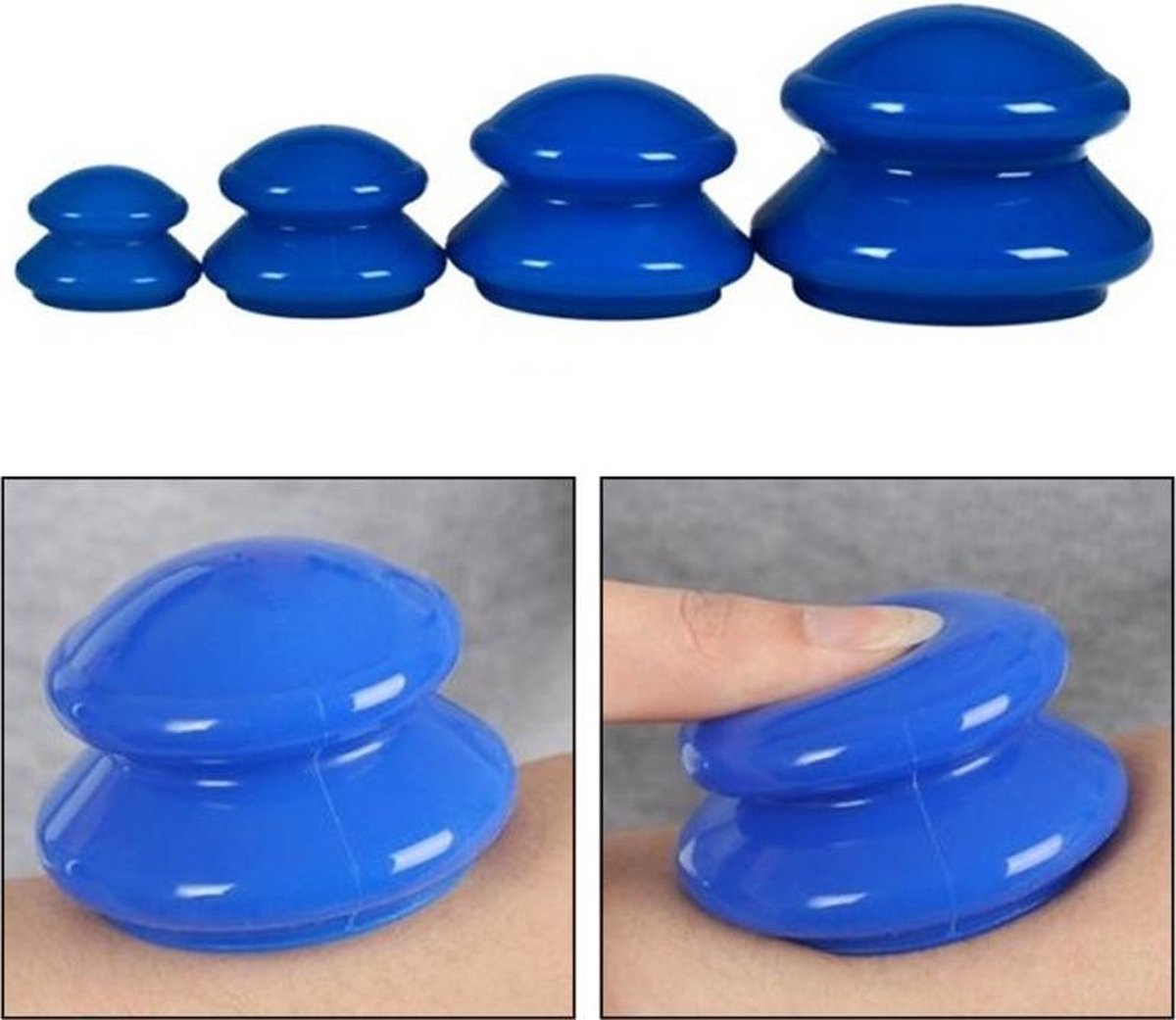 XL Vacuum Anti Cellulitis Massage Cup - Cupping Therapy Set - Siliconen Cuppingset - Blauw