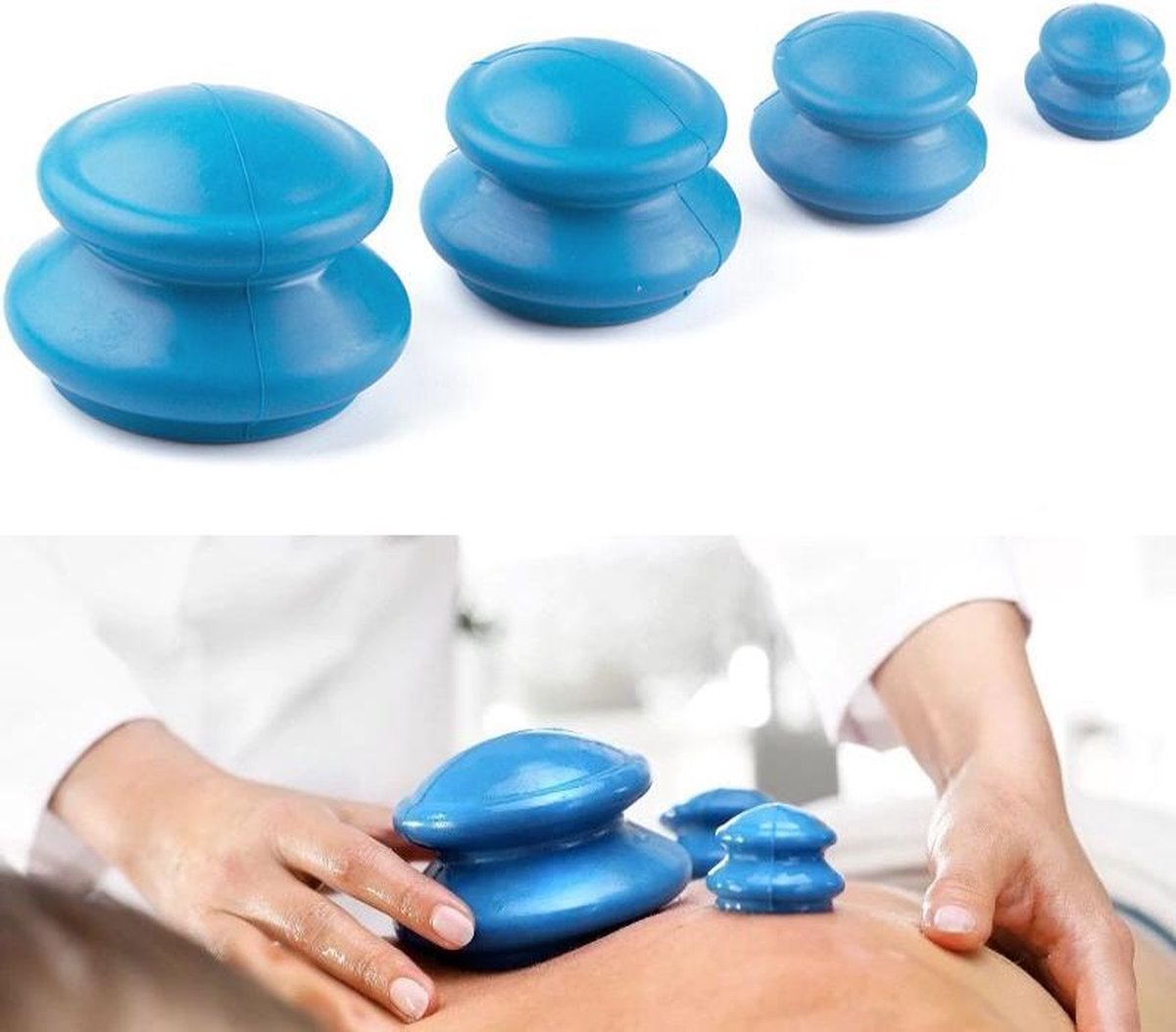 A&K Vacuum Anti Cellulitis Massage Cup XL - Cupping Therapy Set - Siliconen Cuppingset - 4 Stuks