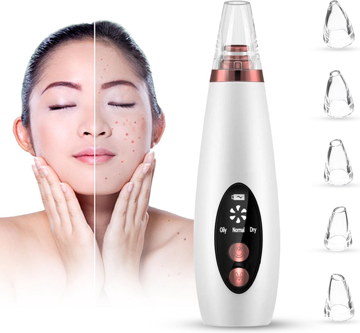 Ferodelli® - Blackhead Remover - mee eters verwijderen - Beste uit de Test - (populair)