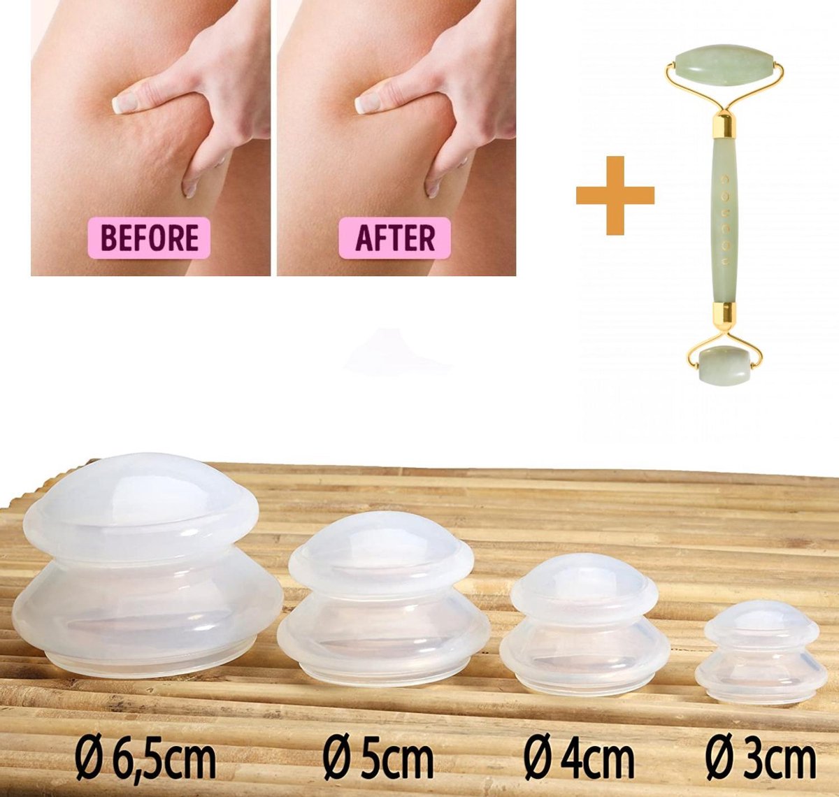 HomeRun™ Cellutite Cups - Massage Cups - Set Van 4 - Anti Cellulites - Cupping Set - Inclusief Massage Roller