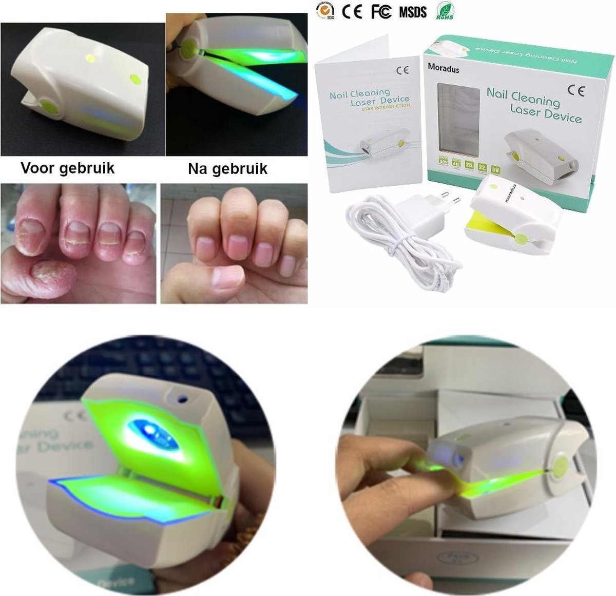 Anti schimmelnagel zelf-laserapparaat