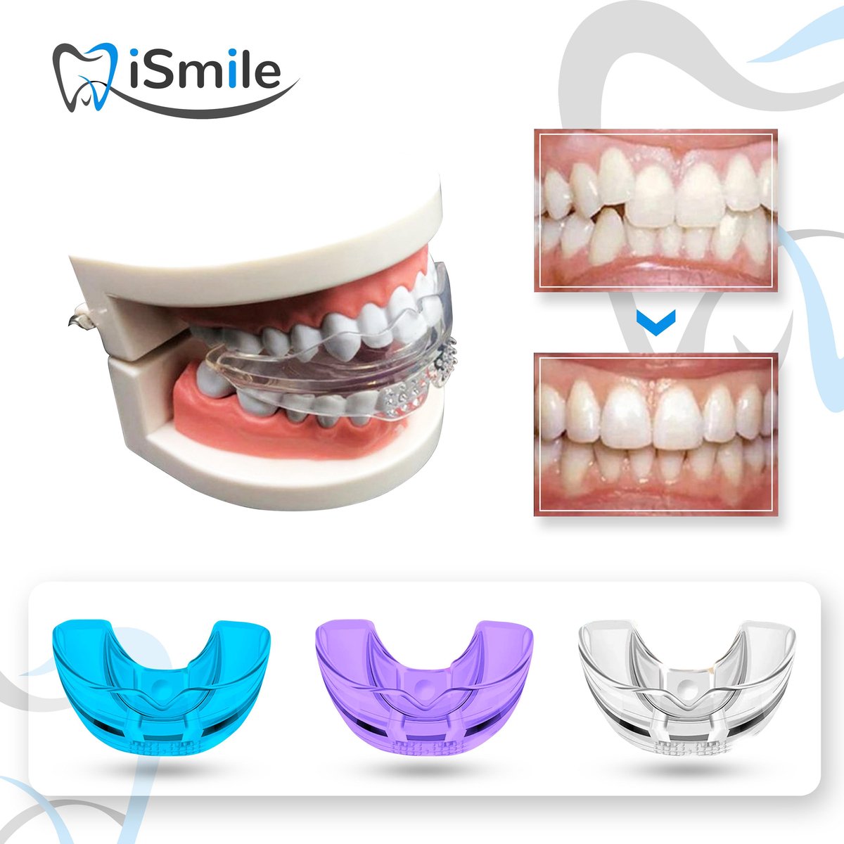 iSmile® - Rechte Tanden Beugel - Rechte Tanden Bitje - Knarsbitje - Nachtbeugel - Nachtbeugel  - Knarsen Bitje - Witte tanden