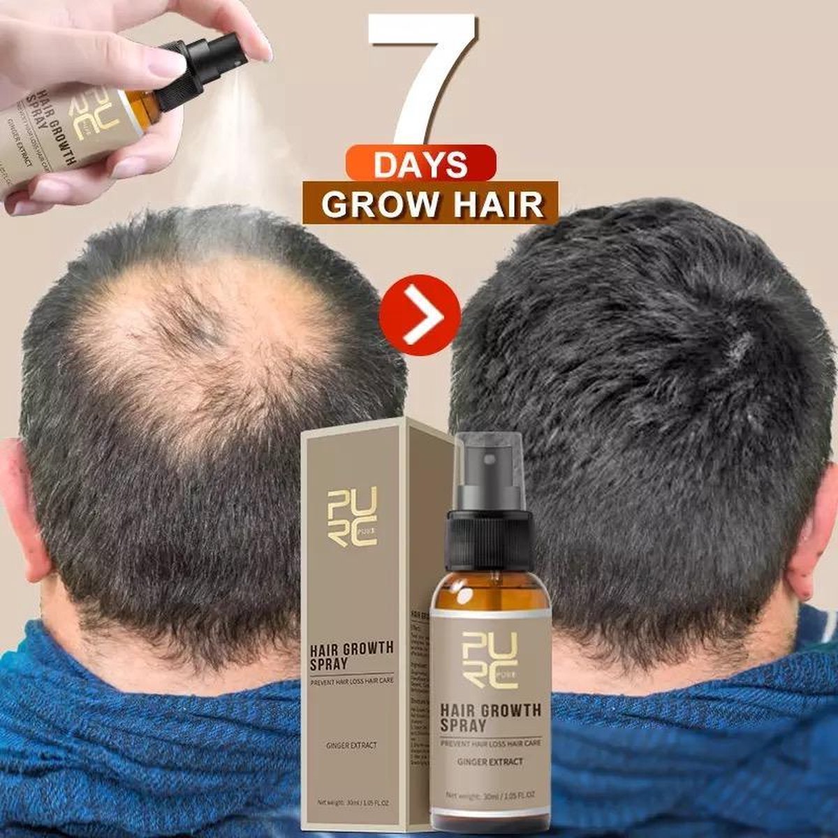 Nieuwe Haargroei Spray | Haarserum | Haarverzorging 30ML