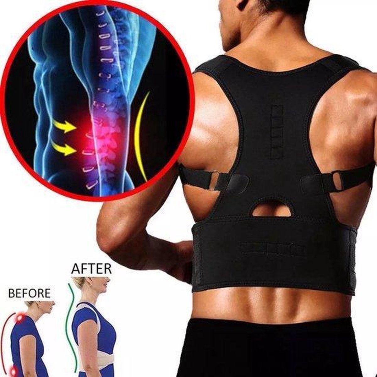 Chibaa Medium Magnetic corrector - houding Correctie Brace - Postuur Corrector - Rug Band / Schouder Band - Steunvest - rugband - verminderd klachten - last van rug - Medium