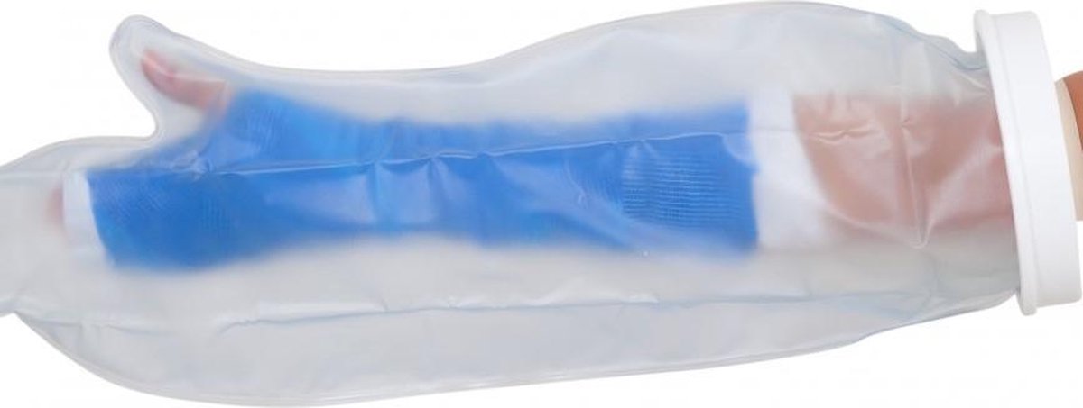 Able 2 gipshoes halve arm - volwassenen