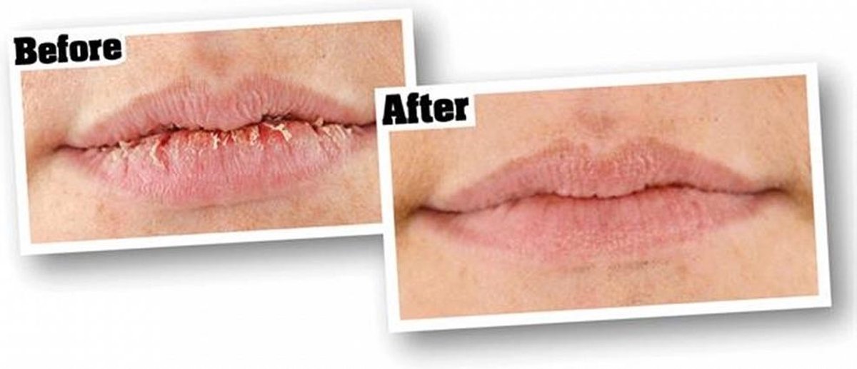 O Keeffes Lip Repair & Protect Stick Spf15