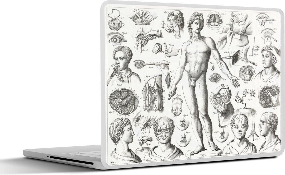 Laptop sticker - 10.1 inch - Illustraties van verschillende chirurgische ingrepen