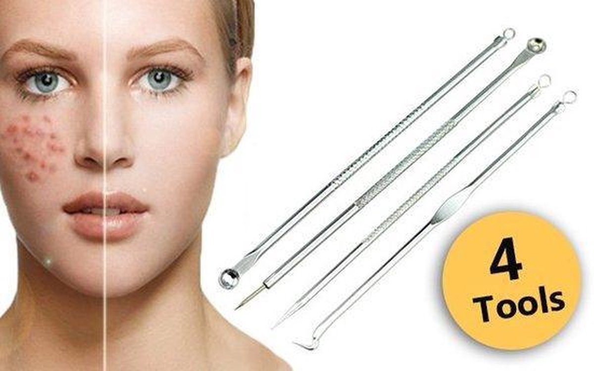 Now4you - Pilaten Comedonenlepels - set van 4 soorten - mee-eters verwijderen