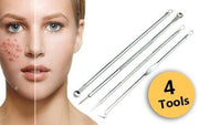 Now4you - Pilaten Comedonenlepels - set van 4 soorten - mee-eters verwijderen