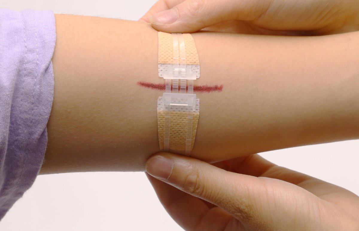Quick Stitch Naaldloze Hechtpleister (1 pleister)