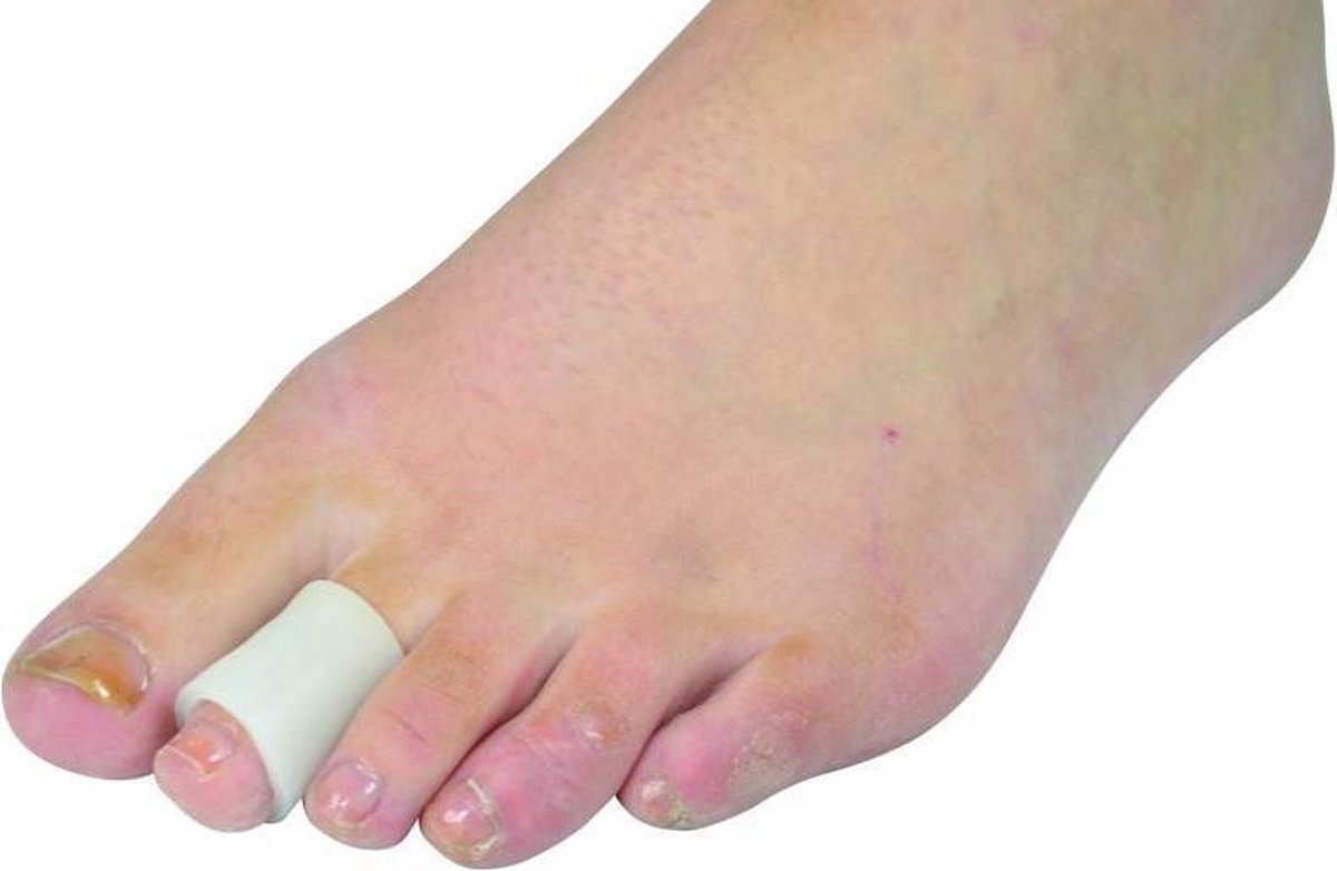 Gel Teenbeschermer  (soft gel) M/L