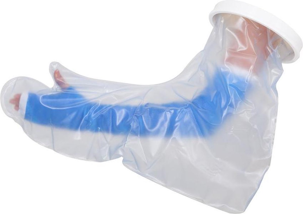 Gipshoes hele arm - volwassene - Atlantis