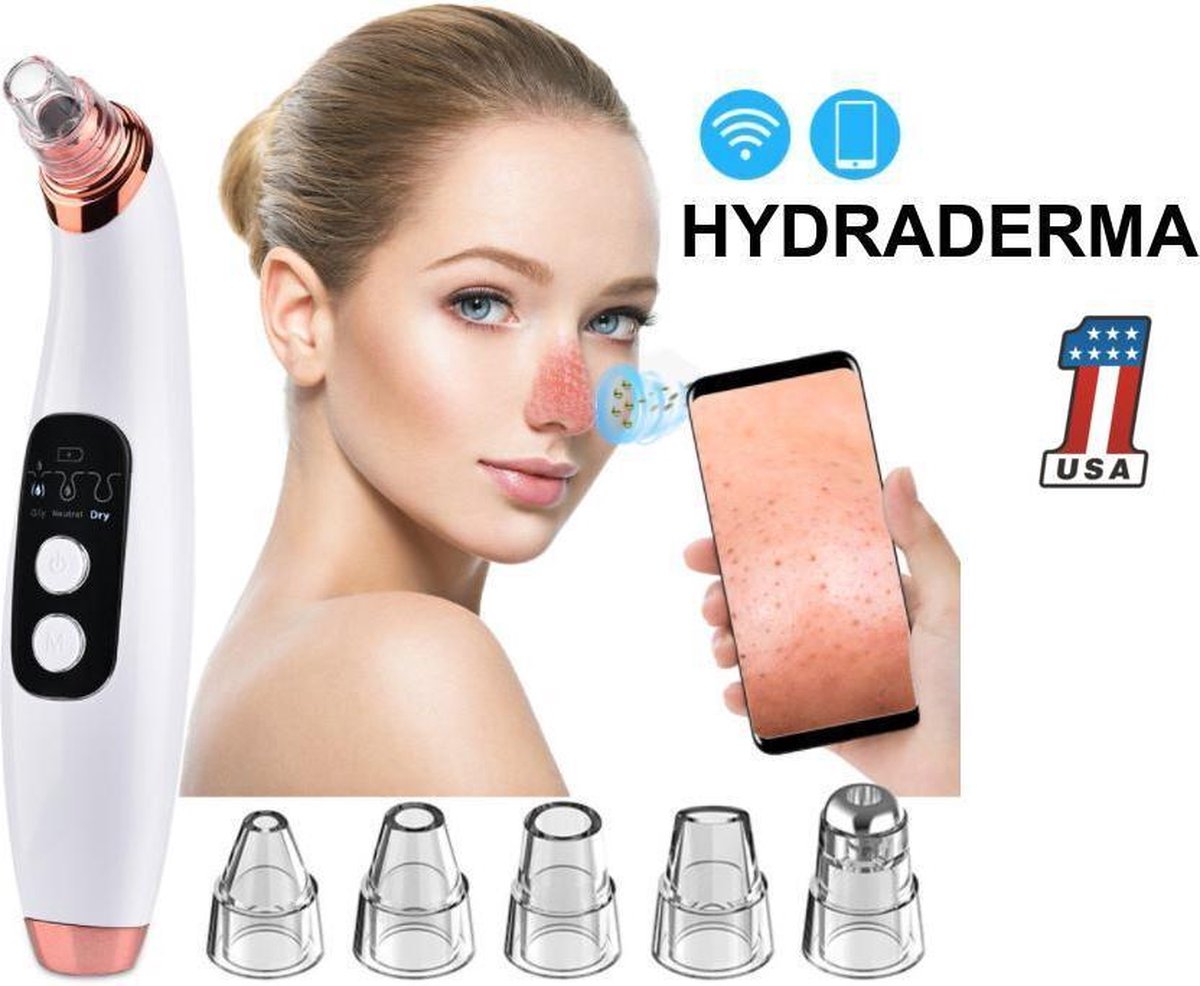 Blackhead Remover – Met Ingebouwde Camera 5 megapixel - Mee eter verwijderaar - vacuum cleaner - Puisten verwijderaar