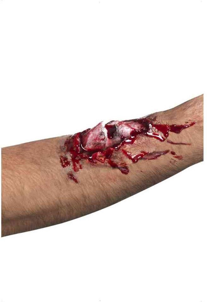 Broken Bone Scar