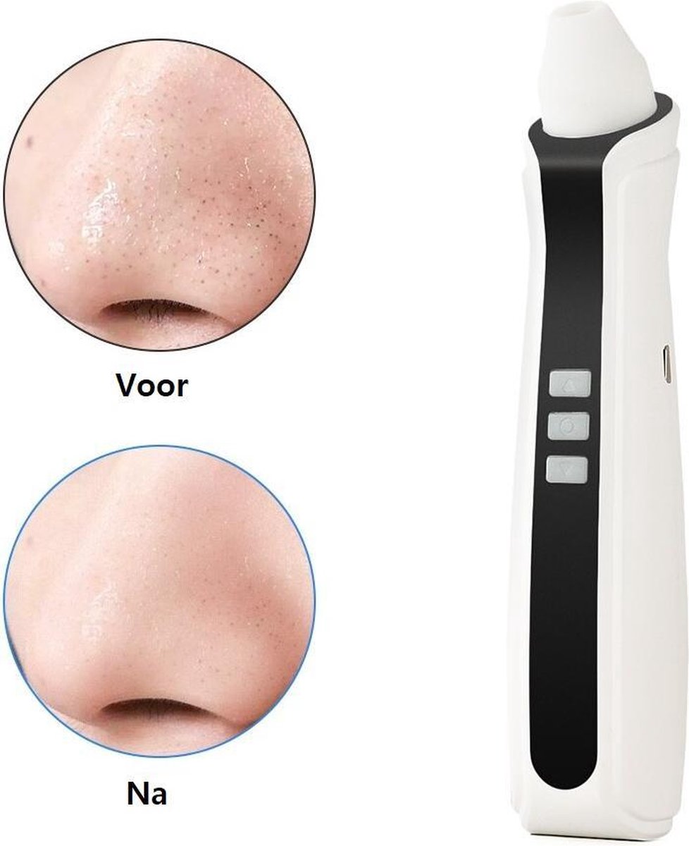Blackhead Remover – Met Ingebouwde Camera - Mee eters verwijderen - Vacuum cleaner - Puisten verwijderaar - Gezichtsreinigingsborstel