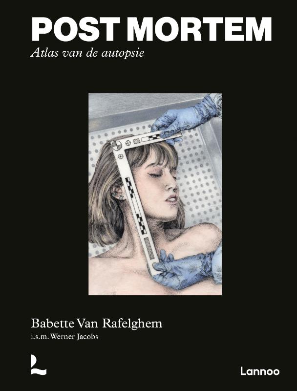 Post mortem. Atlas van de autopsie (Hardback)